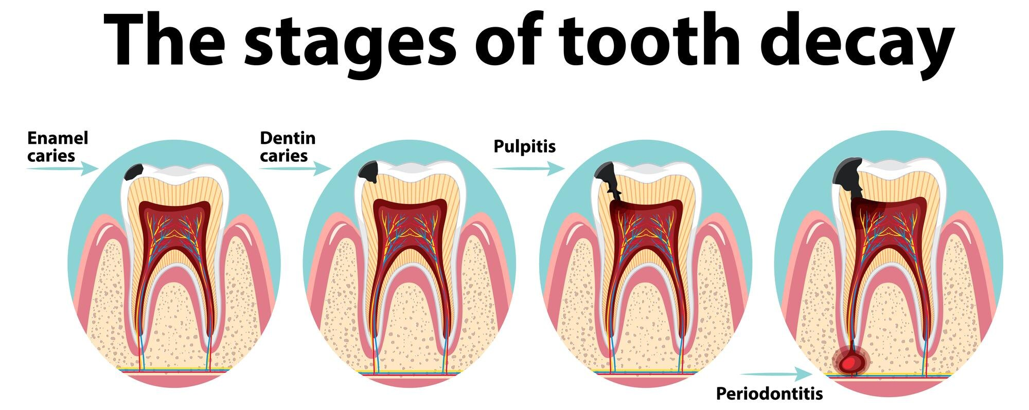 Restorations/Fillings 1 image1 6