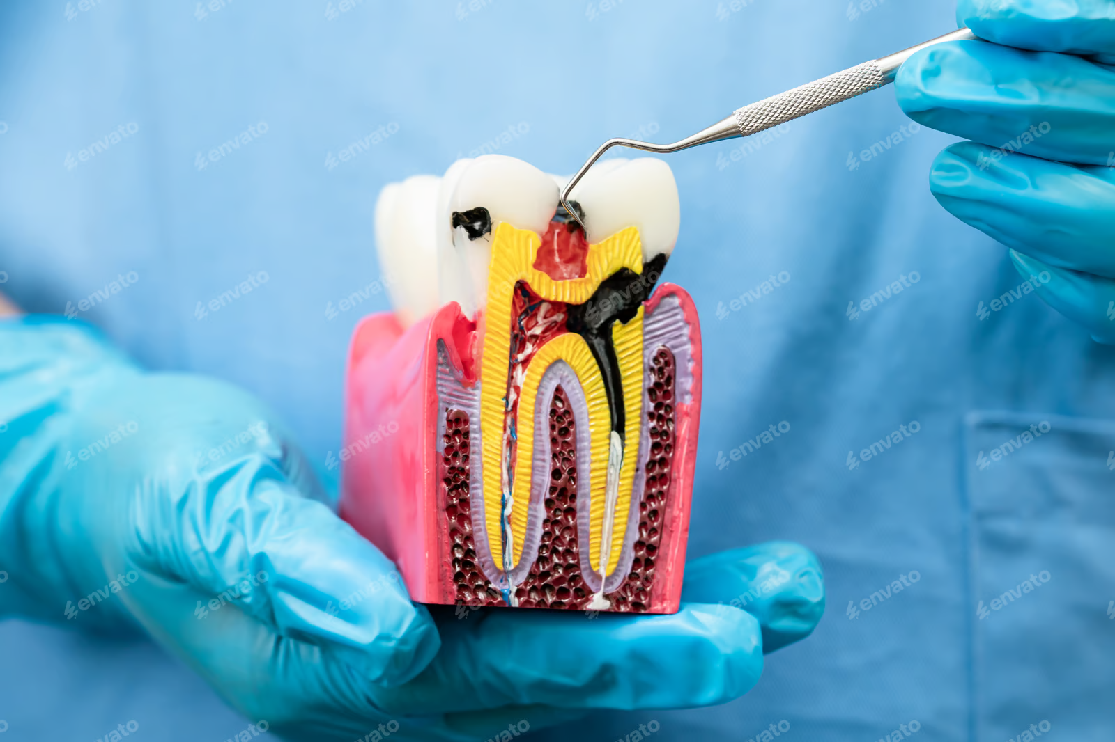 Endodontics 1 image3 4