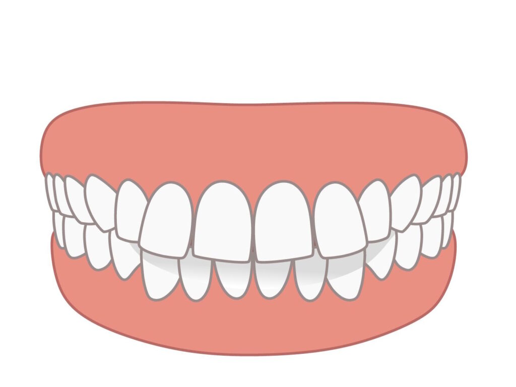 Protrusion